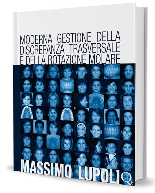 Moderna gestione della discrepanza trasversale e della rotazione molare. Il palatal expander - Massimo Lupoli - copertina