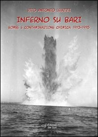 ibs