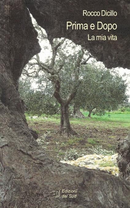 Prima e dopo. La mia vita - Rocco Dicillo - copertina
