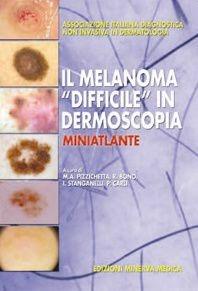 Libro Il melanoma «difficile» in dermoscopia. Miniatlante M. A. Pizzichetta