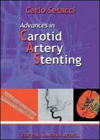 Advances in carotid artery stenting - Carlo Setacci - copertina