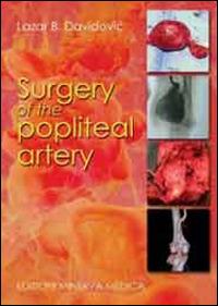 Surgery of the popliteal artery - Lazar B. Davidovic - copertina