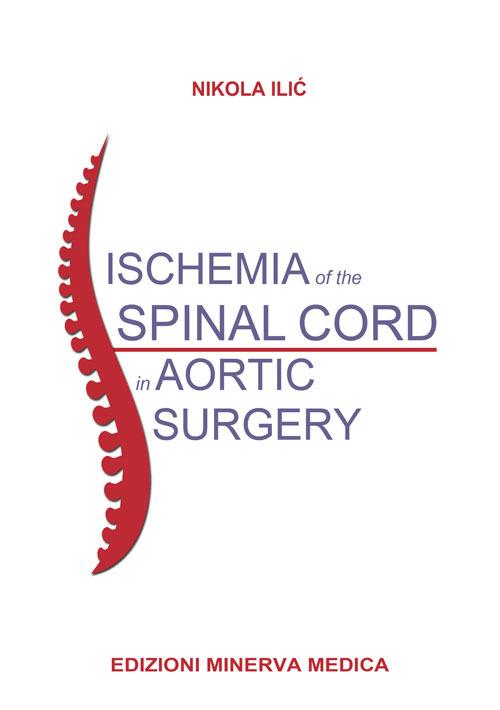 Ischemia of the spinal cord in aortic surgery - Nikola Ilic - copertina