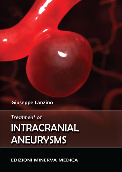 Treatment of intracranial aneurysms - Giuseppe Lanzino - copertina