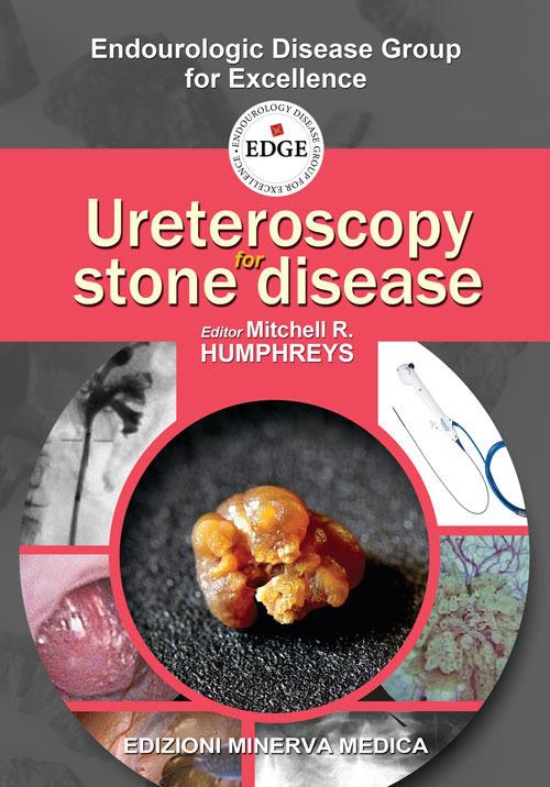 Ureteroscopy for stone disease - copertina
