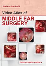 Video atlas of middle ear surgery