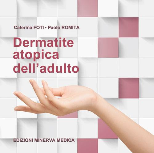 Dermatite atopica dell'adulto - Caterina Foti,Paolo Romita - copertina