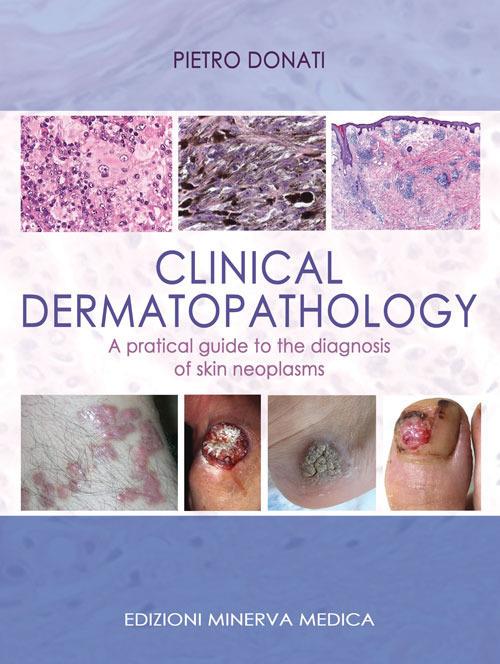 Clinical dermatopathology. A pratical guide to the diagnosis of skin neoplasms - Pietro Donati - copertina