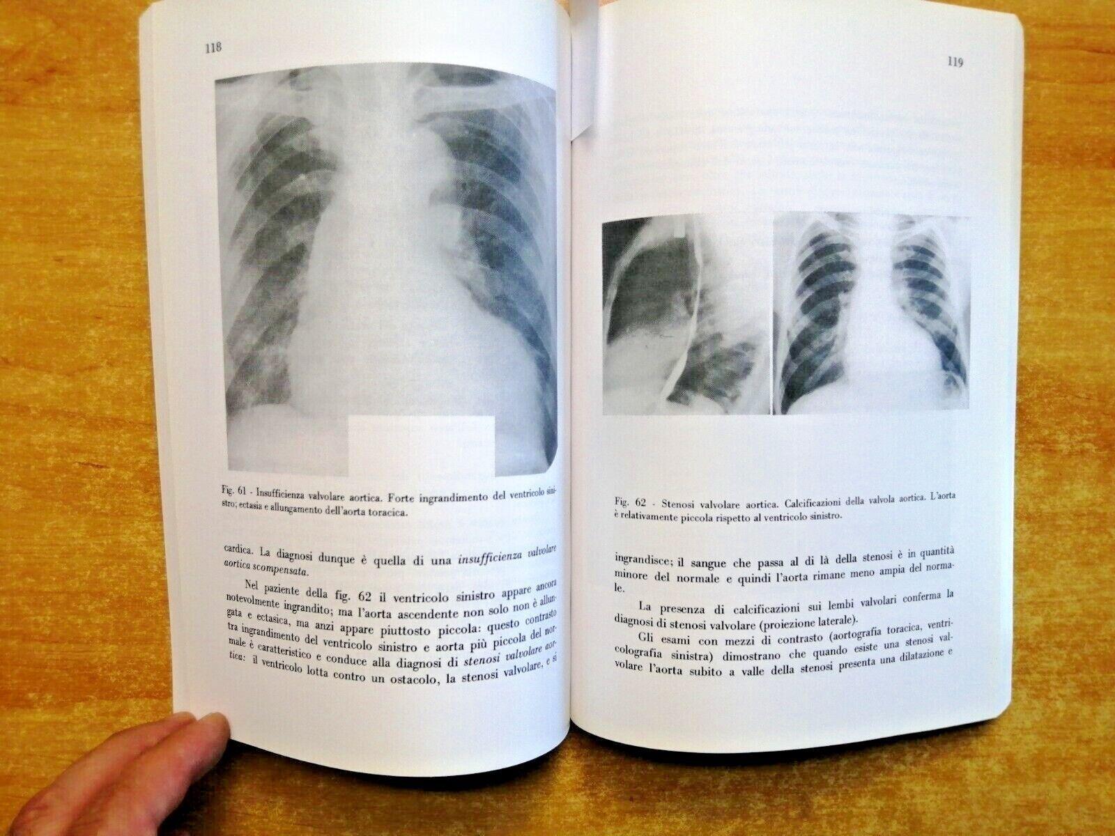 Nozioni di radiologia