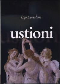 Ustioni - Ugo Lanzalone - copertina