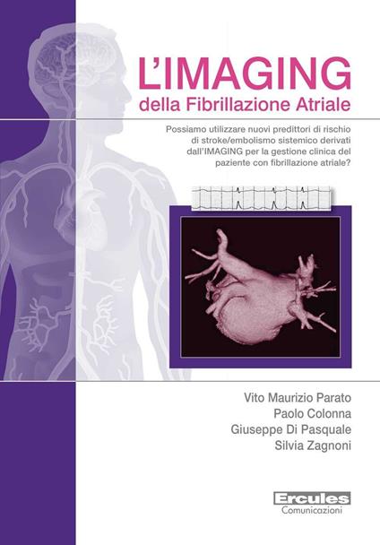 L'imaging della fibrillazione atriale. Possiamo utilizzare nuovi predittori di rischio di stroke/embolismo sistemico derivati dall'imaging per la gestione clinica del paziente con fibrillazione atriale? - Vito Maurizio Parato,Paolo Colonna,Giuseppe Di Pasquale - copertina