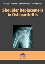Shoulder replacement in osteoarthritis