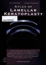 Atlas of lamellar keratoplasty. Con DVD