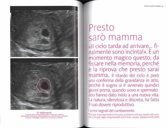La nuova gravidanza. Avere un figlio oggi - Enrico Semprini - 2
