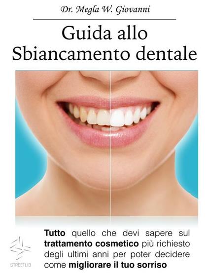 Guida allo sbiancamento dentale - W. Giovanni Megla - ebook