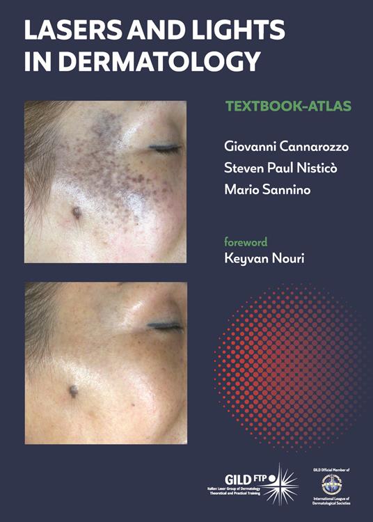 Lasers and lights in dermatology. Textbook-atlas - Giovanni Cannarozzo,Steven Paul Nisticò,Mario Sannino - copertina