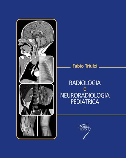 Radiologia e neuroradiologia pediatrica - Fabio Triulzi - copertina