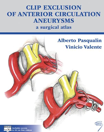 Clip exclusion of anterior circulation aneurysms: a surgical atlas. Con Contenuto digitale per download e accesso on line - Alberto Pasqualin,Vinicio Valente - copertina