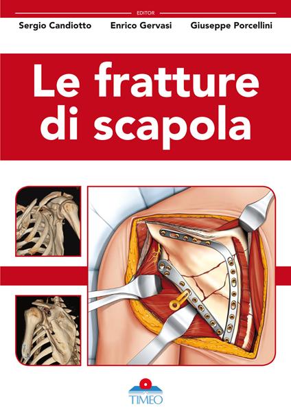 Le fratture di scapola - Sergio Candiotto,Enrico Gervasi,Giuseppe Porcellini - copertina