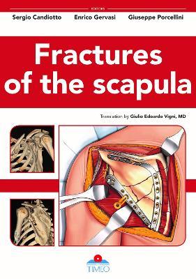 Fractures of the scapula. Ediz. illustrata - Sergio Candiotto,Enrico Gervasi,Giuseppe Porcellini - copertina