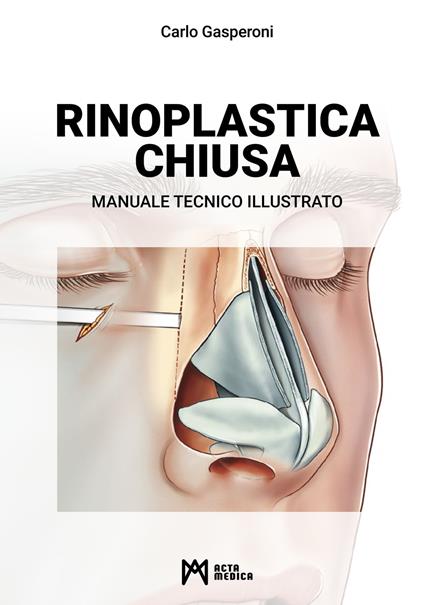Rinoplastica chiusa. Manuale tecnico illustrato - Carlo Gasperoni - copertina