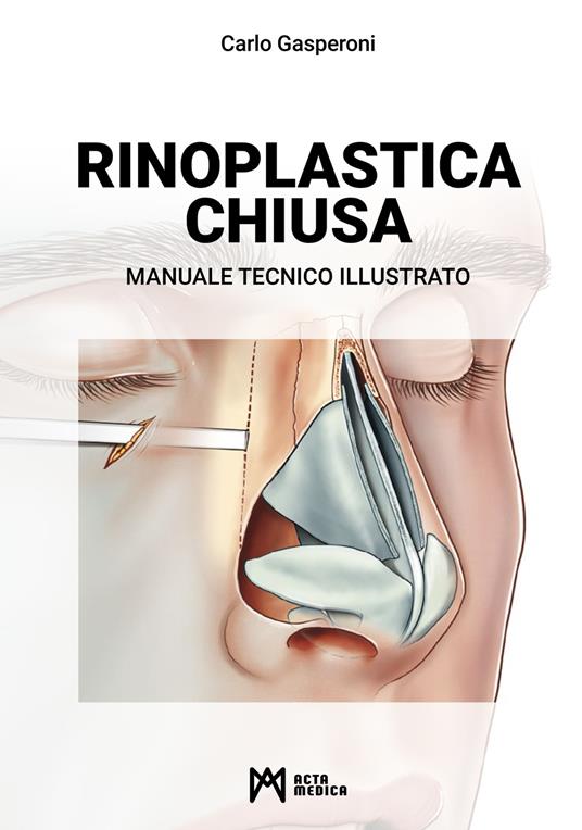 Rinoplastica chiusa. Manuale tecnico illustrato - Carlo Gasperoni - copertina