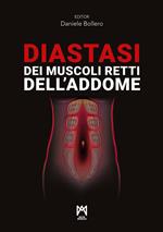 Diastasi dei muscoli retti dell’addome