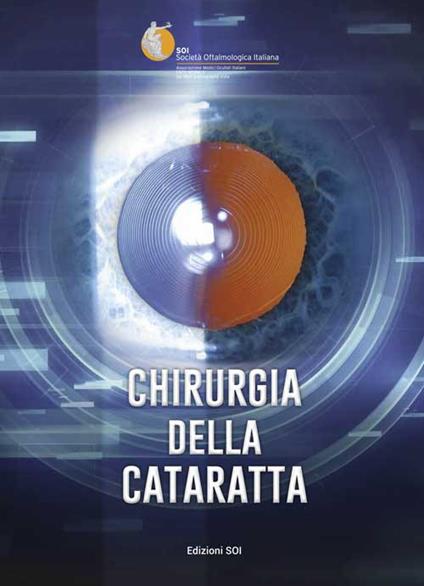 Chirurgia della cataratta. Relazione SOI 2015 - copertina