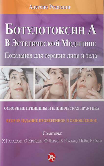 Tossina botulinica A in medicina estetica. Ediz. russa - Alessio Redaelli - copertina