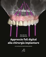 Approccio full digital alla chirurgia implantare
