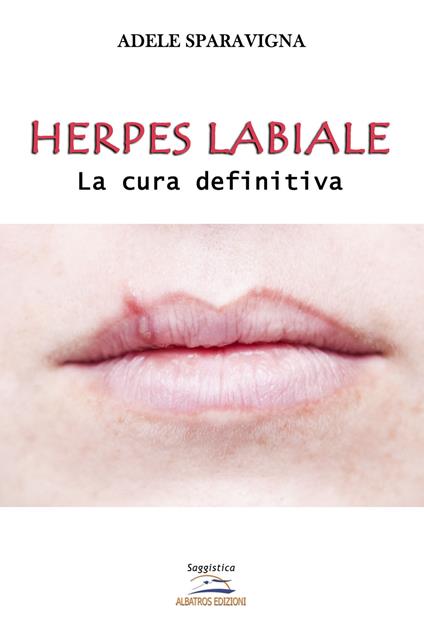Herpes labiale. La cura definitiva. Ediz. per la scuola - Adele Sparavigna - copertina