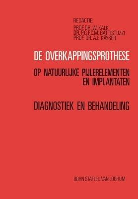 de Overkappingsprothese: Diagnostiek En Behandeling - cover