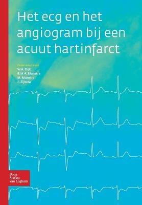 Het ECG En Het Angiogram Bij Een Acuut Hartinfarct - F. Zijlstra,W.A. Dijk,B.M.A. Munstra - cover