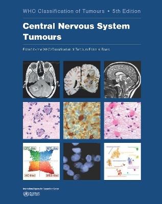 WHO classification of tumours of the central nervous system - International Agency for Research on Cancer - cover