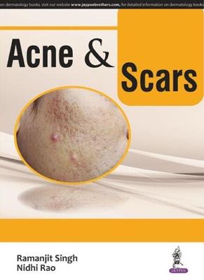 Acne & Scars - Ramanjit Singh,Nidhi Rao - cover