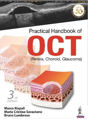 Practical Handbook of OCT: (Retina, Choroid, Glaucoma) - Marco Rispoli,Maria Cristina Savastano,Bruno Lumbroso - cover