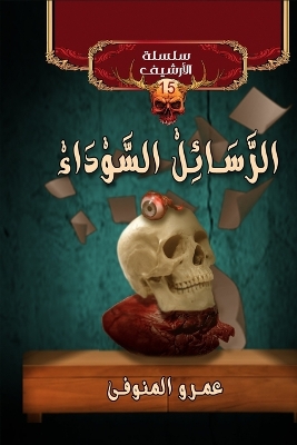 ibs