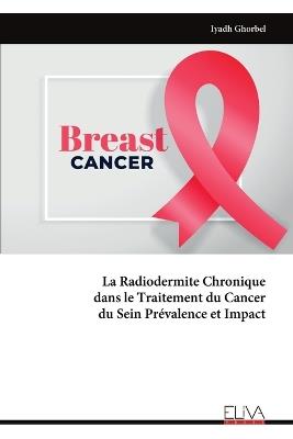 La Radiodermite Chronique dans le Traitement du Cancer du Sein Prévalence et Impact - Iyadh Ghorbel - cover