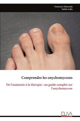 Comprendre les onychomycoses: De l'anatomie à la thérapie: un guide complet sur l'onychomycose - Ouanassa Hamouda - cover