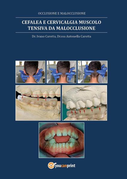 Cefalea e cervicalgia muscolo tensiva da malocclusione - Ivano Carotta,Antonella Carotta - copertina