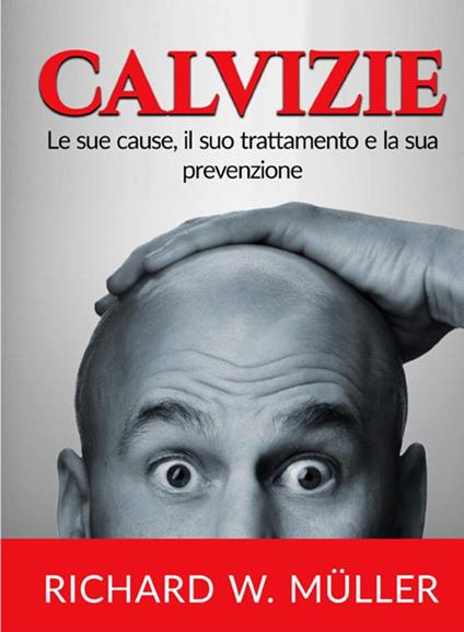 Calvizie. Le sue cause, il suo trattamento e la sua prevenzione - Richard W. Müller - copertina