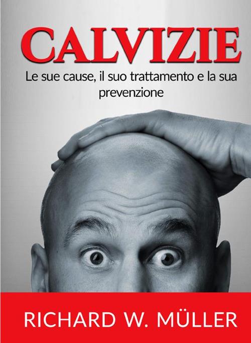 Calvizie. Le sue cause, il suo trattamento e la sua prevenzione - Richard W. Müller - copertina
