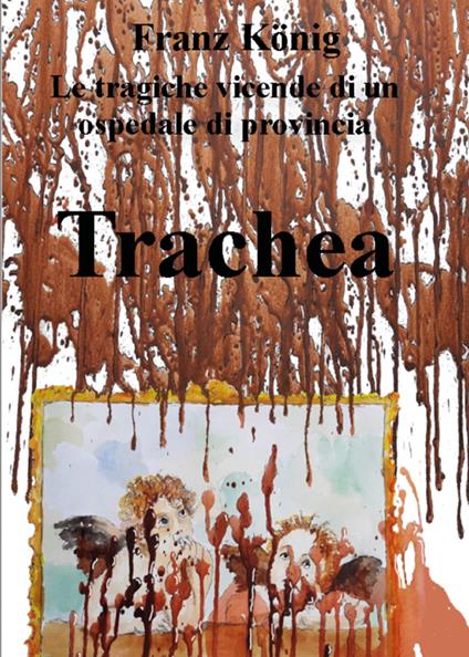 Trachea. Le tragiche vicende di un ospedale di provincia - Franz König - ebook