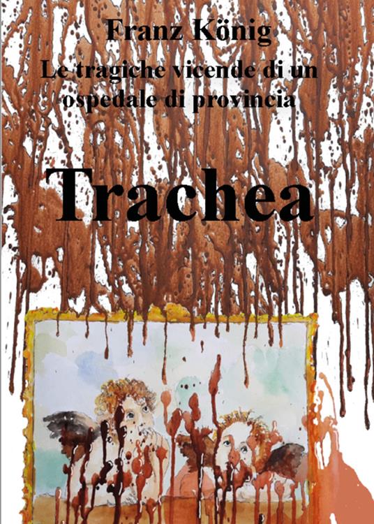 Trachea. Le tragiche vicende di un ospedale di provincia - Franz König - ebook