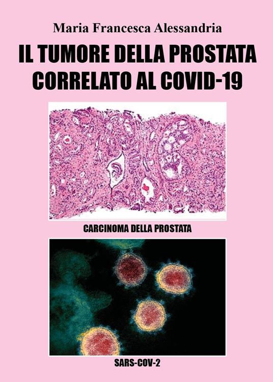 Il tumore alla prostata correlato al Covid-19 - Maria Francesca Alessandria - copertina