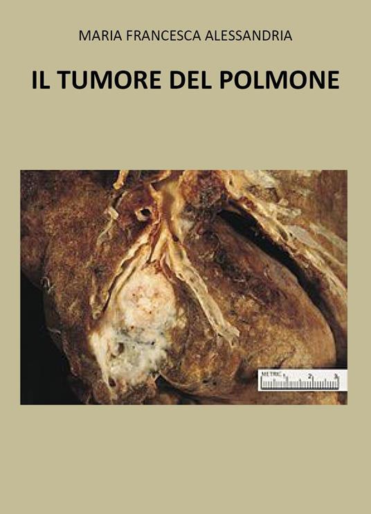 Il tumore nel polmone - Maria Francesca Alessandria - copertina