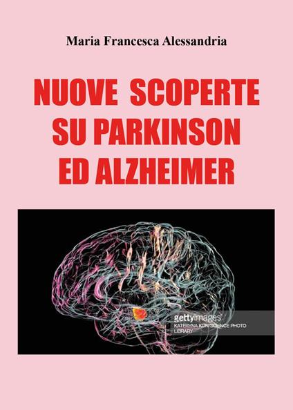 Nuove scoperte sul Parkinson e Alzheimer - Maria Francesca Alessandria - copertina