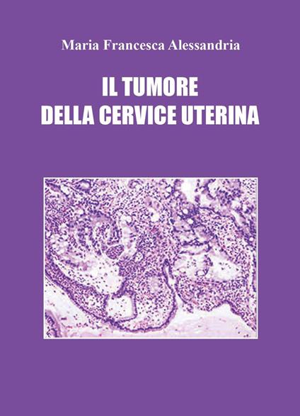 Il tumore della cervice uterina - Maria Francesca Alessandria - copertina