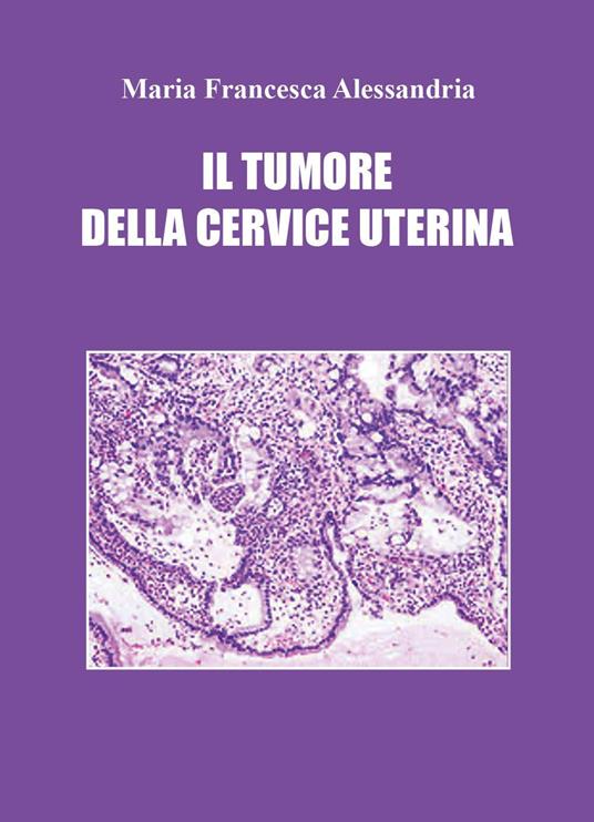 Il tumore della cervice uterina - Maria Francesca Alessandria - copertina