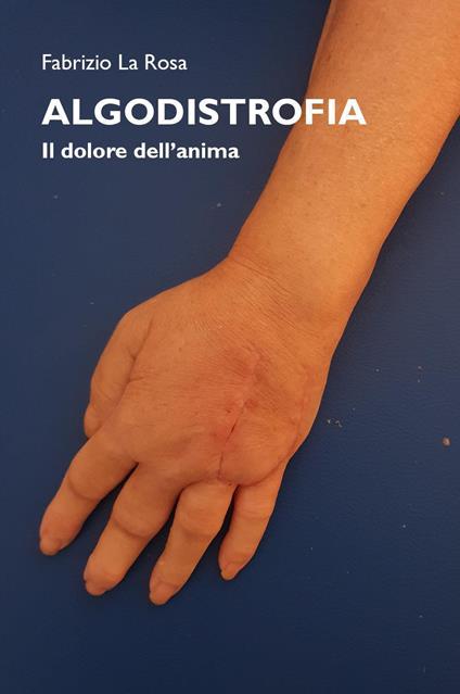 Algodistrofia. Il dolore dell'anima - Fabrizio La Rosa - copertina